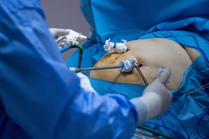 Bariatric/Metabolic Surgery
